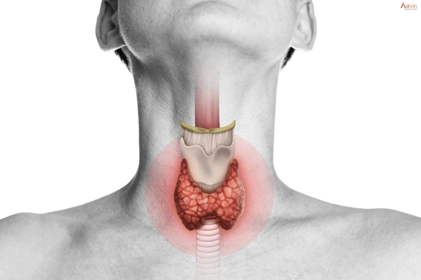 thyroid lumps
